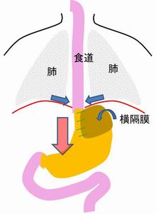 食道疾患右