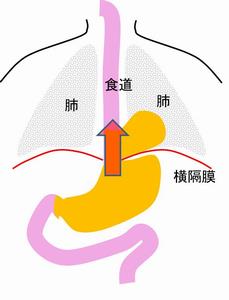 食道疾患左