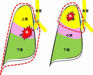 呼吸器疾患7