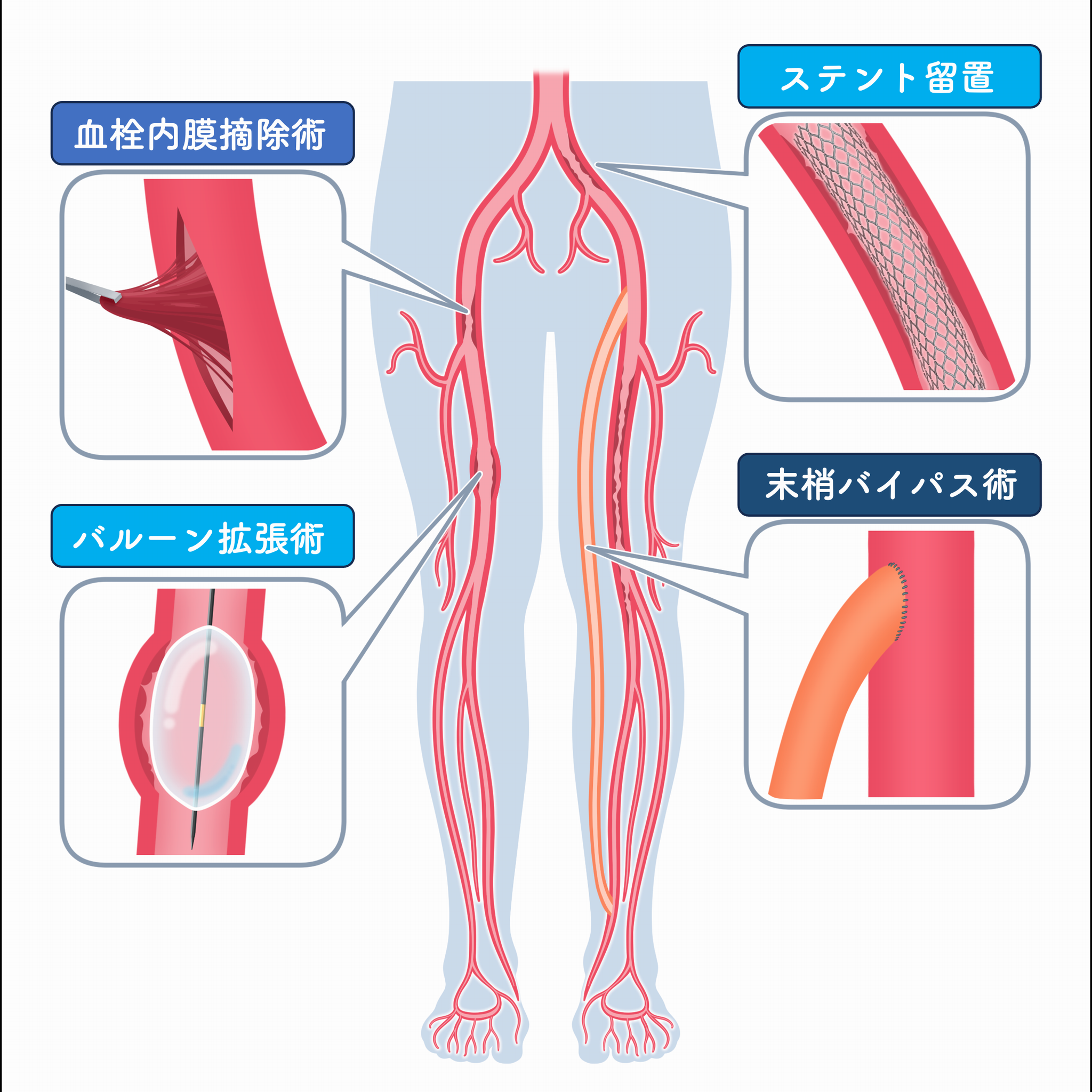 kekkousaikenn2