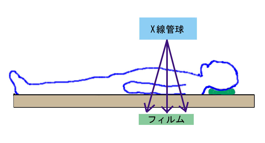 X線検査のことを表した図