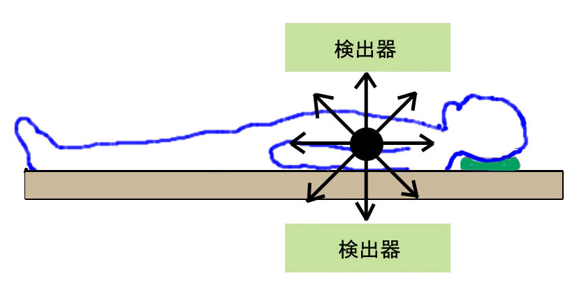 ＲＩ検査を表した図