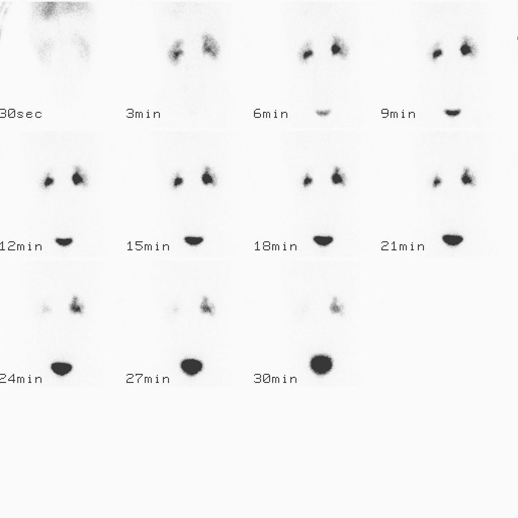 腎臓の様子を分単位で比べた写真