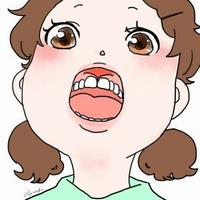上唇小帯に注意