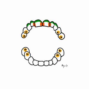 むし歯になりやすいところ