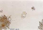 微生物のボルティセラの写真